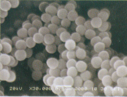 T-1 PVDF SEM photograph